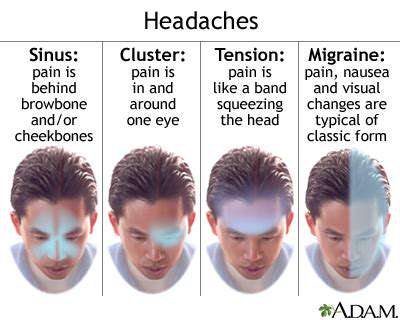 CommonCausesofHeadPainWhenTurningtheHead