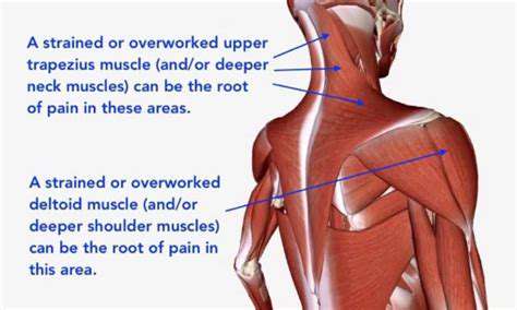 Head Hurting After Workout: Possible Causes and Solutions