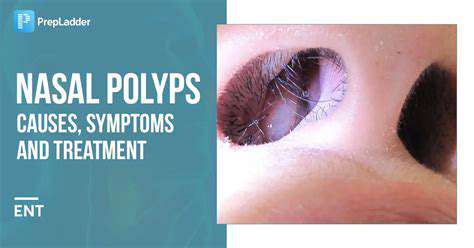 NasalPolyps:ALessCommon,ButImportant,Consideration