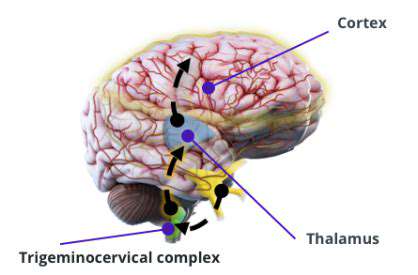 TheTrigeminovascularSystem:AKeyPlayerinMigrainePathophysiology