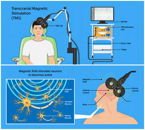 TranscranialMagneticStimulation(TMS)forMigrainePrevention